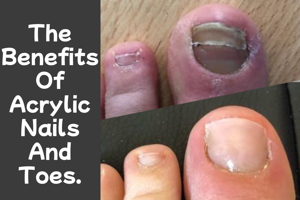 The Benefits Of Acrylic Nails And Toes.