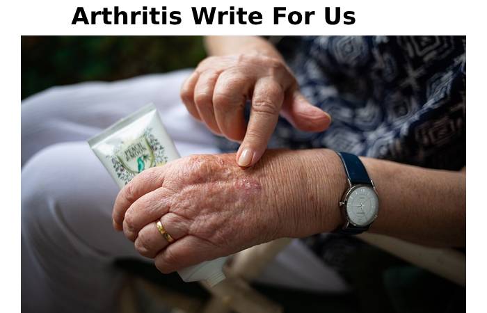 Arthritis