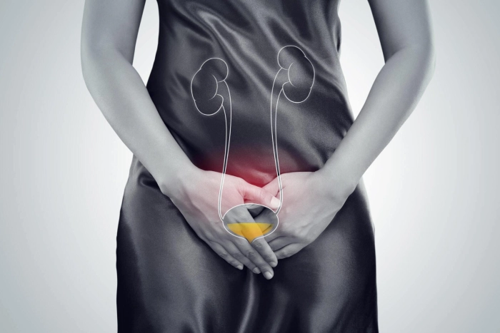 Bladder Infection Write For Us