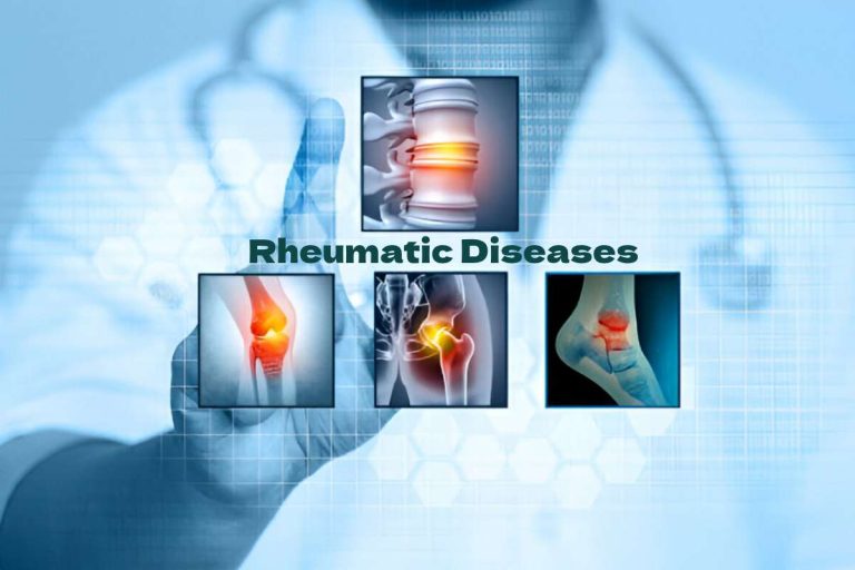 Rheumatic Diseases