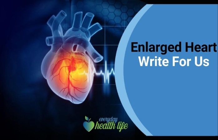 Enlarged Heart Write For Us