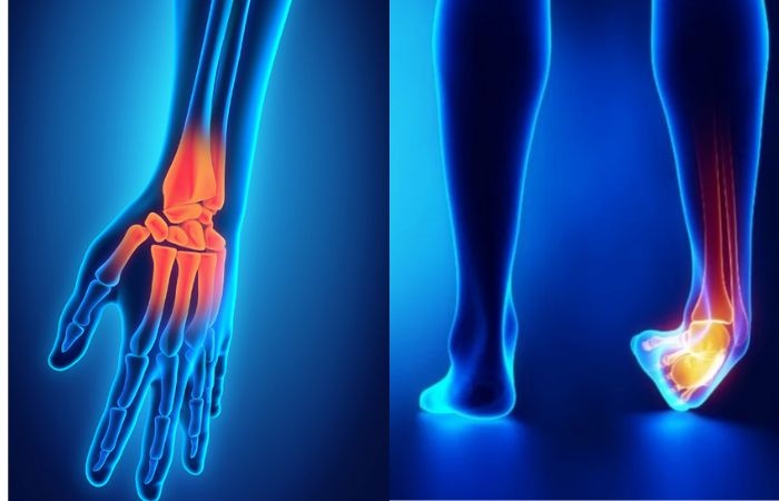 Wellhealthorganic Surgery For Wrist And Ankle Injuries